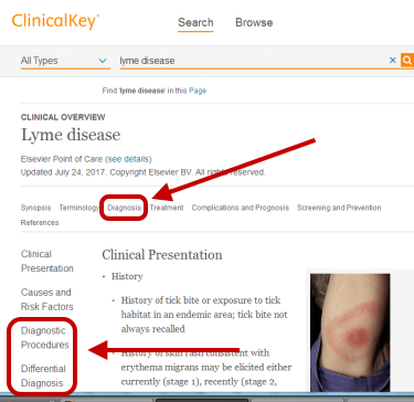 ClinicalKey Example
